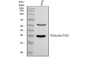 Western blot analysis of TAZ using anti-TAZ antibody (ABIN7602384).