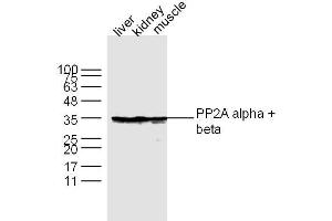 Lane 1: Liver lysates Lane 2: Kidney lysates Lane 3: Muscle lysates probed with PP2A alpha + beta Polyclonal Antibody, Unconjugated  at 1:300 dilution and 4˚C overnight incubation. (PP2A alpha/beta anticorps  (AA 205-309))