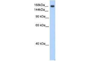 WB Suggested Anti-SCN5A Antibody Titration:  0. (SCN5A anticorps  (C-Term))