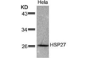 Image no. 1 for anti-Heat Shock 27kDa Protein 1 (HSPB1) (AA 76-80) antibody (ABIN197489) (HSP27 anticorps  (AA 76-80))