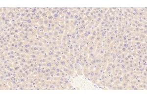 Detection of TFR in Mouse Liver Tissue using Polyclonal Antibody to Transferrin Receptor (TFR) (Transferrin Receptor anticorps  (AA 572-757))
