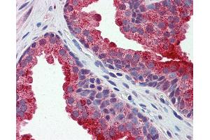 Anti-APEH antibody IHC of human prostate. (APEH anticorps  (AA 144-193))