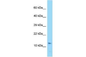 WB Suggested Anti-Rprml Antibody Titration: 1. (RPRML anticorps  (Middle Region))