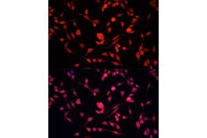 Immunofluorescence analysis of NIH/3T3 cells using YB-1/YB-1/YBX1 antibody (ABIN7271411) at dilution of 1:100.