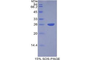 SDS-PAGE analysis of Human Cathepsin S Protein. (Cathepsin S Protein (CTSS))