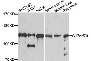 Western blot analysis of extracts of various cell lines, using C17orf70 antibody. (C17orf70 anticorps)