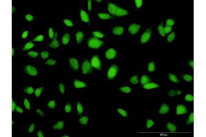 Immunofluorescence of purified MaxPab antibody to C12orf24 on HeLa cell. (C12ORF24 anticorps  (AA 1-273))