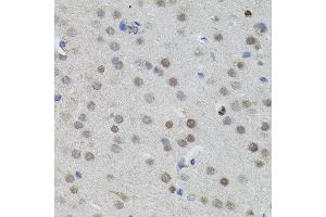 Immunohistochemistry of paraffin-embedded mouse brain using MYCN antibody. (MYCN anticorps)