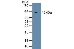 Detection of Recombinant Bcl7A, Human using Polyclonal Antibody to B-Cell CLL/Lymphoma 7A (Bcl7A) (BCL7A anticorps  (AA 1-210))