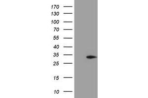 Western Blotting (WB) image for anti-Methylmalonic Aciduria (Cobalamin Deficiency) CblC Type, with Homocystinuria (MMACHC) antibody (ABIN1499510) (MMACHC anticorps)
