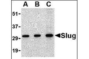 Western blot analysis of Slug in 293 cell lysate with this product at in (A) 0. (SLUG anticorps  (Center))
