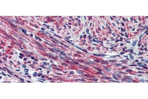 Rabbit Anti-POSTN Antibody  arp41571 Paraffin Embedded Tissue: Human Uterus Antibody Concentration: 5 ug/ml