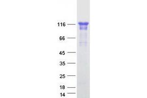 Validation with Western Blot