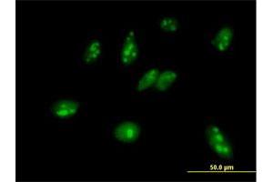 Immunofluorescence of purified MaxPab antibody to MPHOSPH6 on HeLa cell.