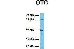 Host:  Rabbit  Target Name:  OTC  Sample Tissue:  Human HepG2  Antibody Dilution:  1.