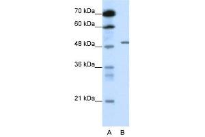 GABRB2 antibody used at 0. (GABRB2 anticorps)