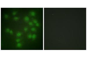 Immunofluorescence analysis of HUVEC cells, using PTTG1 antibody.