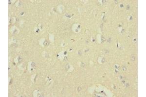 Immunohistochemistry of paraffin-embedded human brain tissue using ABIN7161138 at dilution of 1:100 (UBE2F anticorps  (AA 1-185))