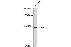 Western blot analysis of extracts of Rat brain, using HMGCR Rabbit pAb (ABIN3022293, ABIN3022294, ABIN3022295, ABIN1513022 and ABIN6218714) at 1:1000 dilution.