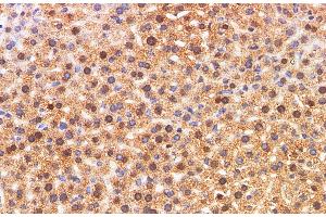 Immunohistochemistry of paraffin-embedded Mouse liver using S100A11 Polyclonal Antibody at dilution of 1:200 (S100A11 anticorps)