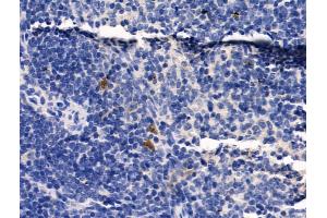 ABIN6259651 and ABIN6268999 at 1/100 staining Mouse spleen tissue by IHC-P. (Serotonin Receptor 1A anticorps  (Internal Region))