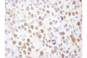 Immunohistochemistry (IHC) image for anti-RAD17 (RAD17) (pSer645) antibody (ABIN7449387) (RAD17 anticorps  (pSer645))