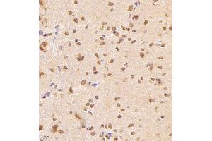Immunohistochemistry of paraffin embedded rat brain using NSD3 (ABIN7076233) at dilution of 1:1400 (400x lens) (WHSC1L1 anticorps)