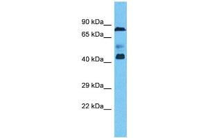 Host:  Rabbit  Target Name:  ZNF362  Sample Type:  Ovary Tumor lysates  Antibody Dilution:  1. (ZNF362 anticorps  (N-Term))