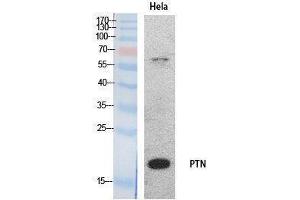 Western Blotting (WB) image for anti-Pleiotrophin (PTN) (Internal Region) antibody (ABIN3178535) (Pleiotrophin anticorps  (Internal Region))
