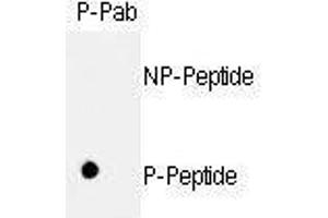 Dot blot analysis of anti-hRb- Phospho-specific Pab (ABIN389648 and ABIN2839638) on nitrocellulose membrane. (Retinoblastoma 1 anticorps  (pSer811))