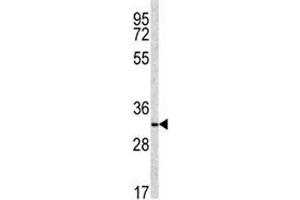 Western blot analysis of NQO1 antibody and NCI-H460 lysate