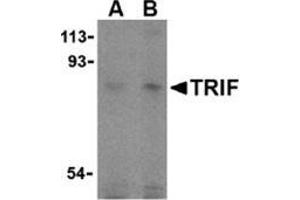 Western blot analysis of TRIF in human lung cell lysates with this product at (A) 2 and (B) 4 μg/ml. (TICAM1 anticorps  (C-Term))