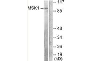 Western blot analysis of extracts from 293 cells, treated with UV 15', using MSK1 Antibody . (MSK1 anticorps  (Internal Region))