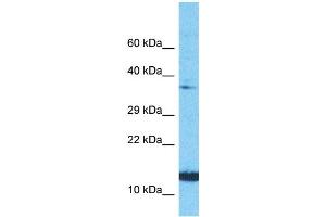 Host:  Rabbit  Target Name:  NINJ1  Sample Type:  PANC1 Whole Cell lysates  Antibody Dilution:  1. (NINJ1 anticorps  (N-Term))