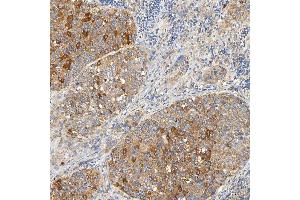 IHC analysis of SNPH using anti-SNPH antibody (ABIN7601724). (Syntaphilin anticorps  (AA 43-482))