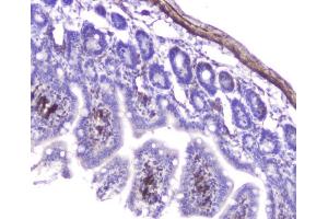IHC analysis of Hsp27 using anti-Hsp27 antibody (ABIN6719322).