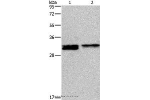 Western blot analysis of Hela and Jurkat cell, using FOSL1 Polyclonal Antibody at dilution of 1:615 (FOSL1 anticorps)