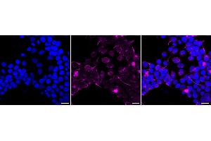 Immunocytochemical staining of HeLa cells with Cleaved PARP antibody (ABIN7799864), 1:1,000).