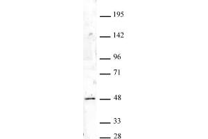 HOXA9 antibody (pAb) tested by Western blot. (HOXA9 anticorps  (N-Term))