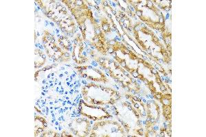 Immunohistochemistry of paraffin-embedded mouse kidney using MSP/MST1 Rabbit mAb (ABIN1680891, ABIN1680890, ABIN3015057 and ABIN3015058) at dilution of 1:100 (40x lens).