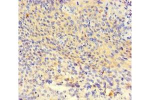 Immunohistochemistry of paraffin-embedded human thyroid tissue using ABIN7162411 at dilution of 1:100 (NR1H3 anticorps  (AA 1-402))