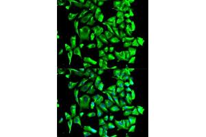 Immunofluorescence analysis of U2OS cells using HSP90AB1 antibody.