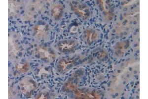 Detection of LSR in Human Kidney Tissue using Polyclonal Antibody to Lipolysis Stimulated Lipoprotein Receptor (LSR)