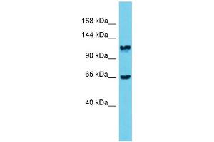 Host: Rabbit  Target Name: Mprip  Sample Tissue: Rat Stomach lysates  Antibody Dilution: 1. (MPRIP anticorps  (Middle Region))