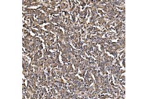 IHC analysis of PI 3 Kinase p85 alpha/PIK3R1 using anti-PI 3 Kinase p85 alpha/PIK3R1 antibody (ABIN7599781). (PIK3R1 anticorps  (AA 117-153))