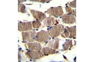 Immunohistochemistry analysis in formalin fixed and paraffin embedded human skeletal muscle reacted withPION / GSAP (C-term) Antibody (C-term) followed by peroxidase conjugation of the secondary antibody and DAB staining.
