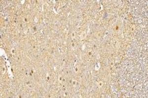 Immunohistochemistry analysis of paraffin-embedded mouse spinal cord using,GDF6 (ABIN7074132) at dilution of 1: 1000