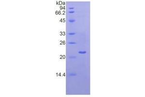 SDS-PAGE analysis of Mouse Laminin gamma 1 Protein. (Laminin gamma 1 Protéine)