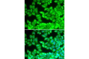 Immunofluorescence analysis of U20S cell using CD40LG antibody. (CD40 Ligand anticorps  (AA 47-223))