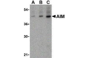 Western Blotting (WB) image for anti-CD5 Molecule-Like (CD5L) (N-Term) antibody (ABIN2472166)